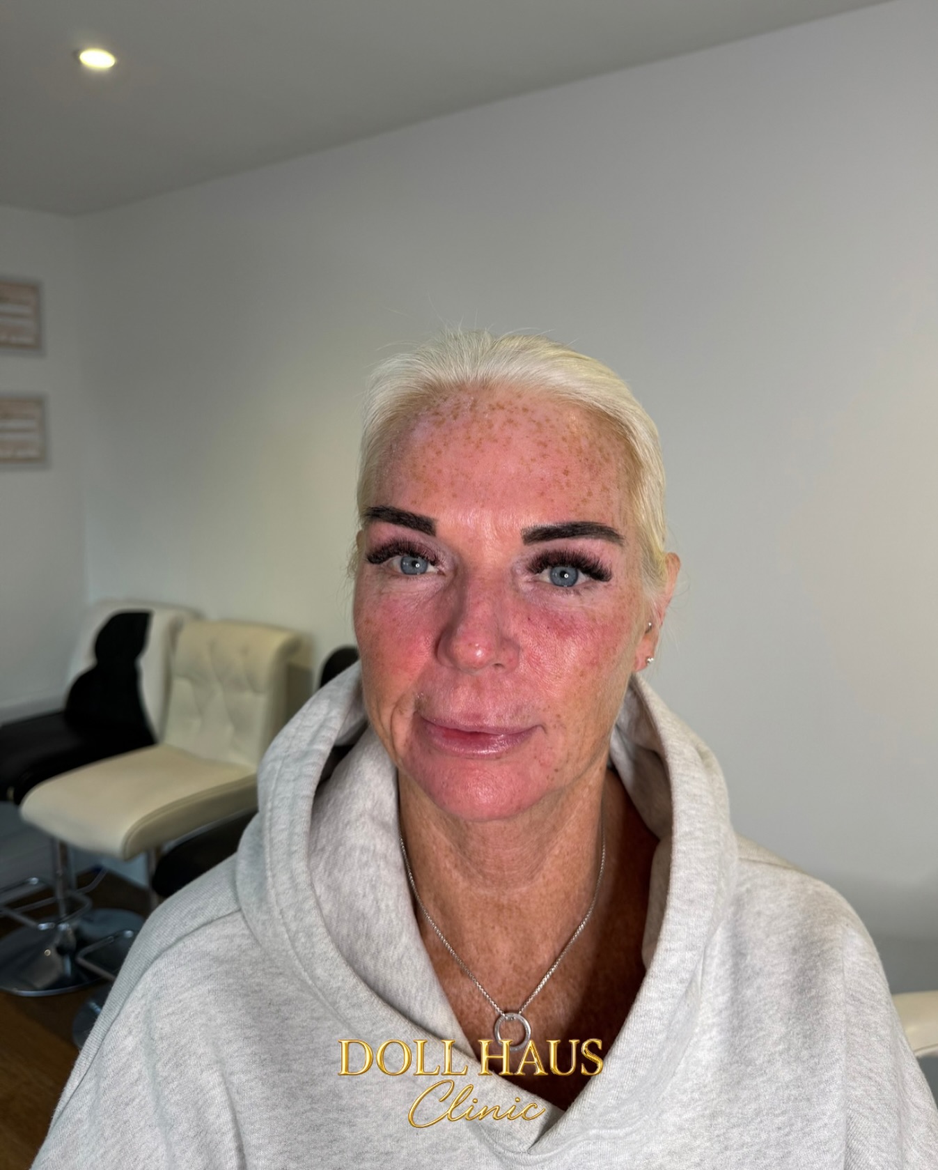 A Doll Haus Clinic treatment room with a client after her appointment